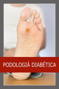 Podologia diabetica